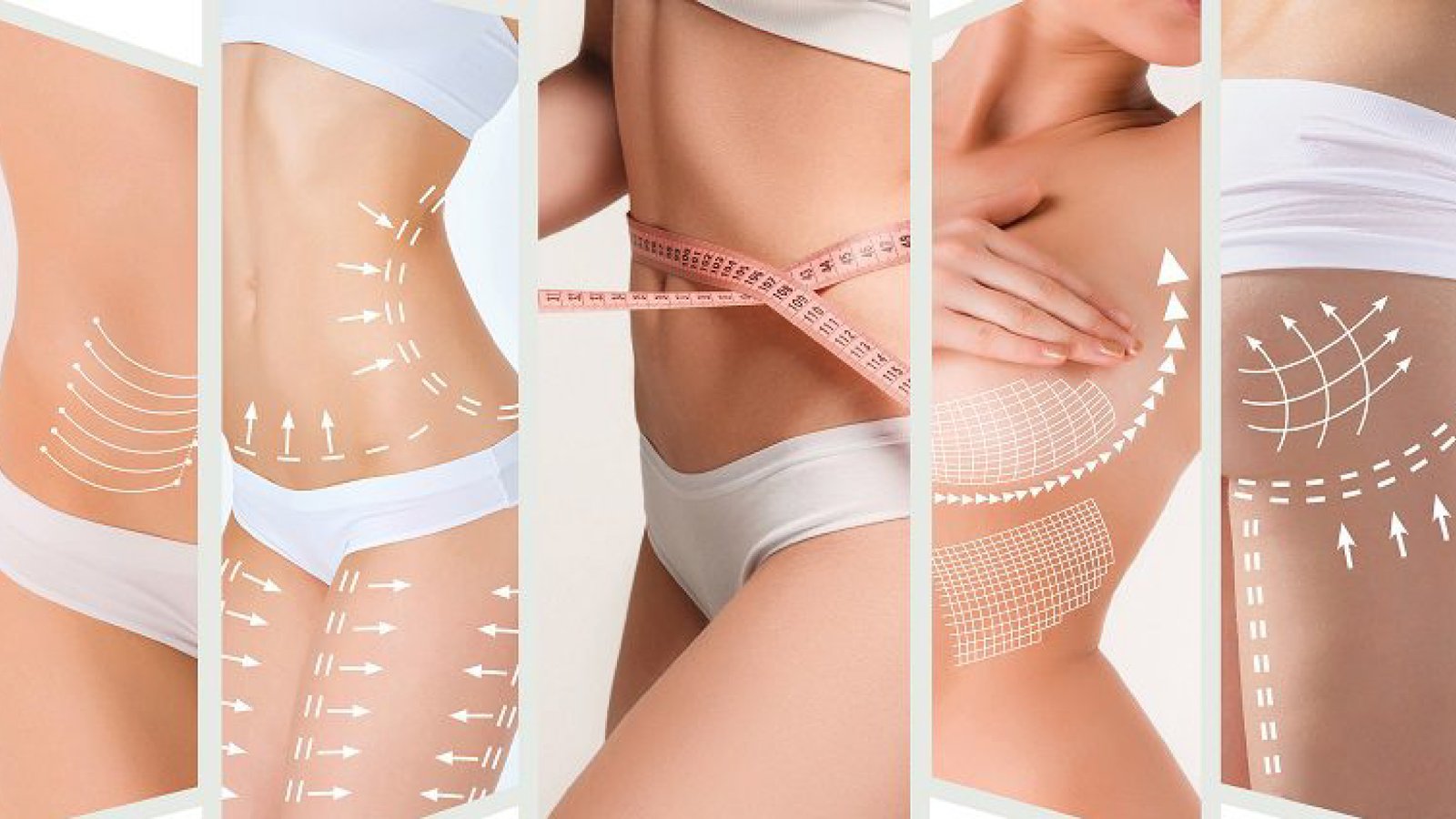 Body Lift Surgery
